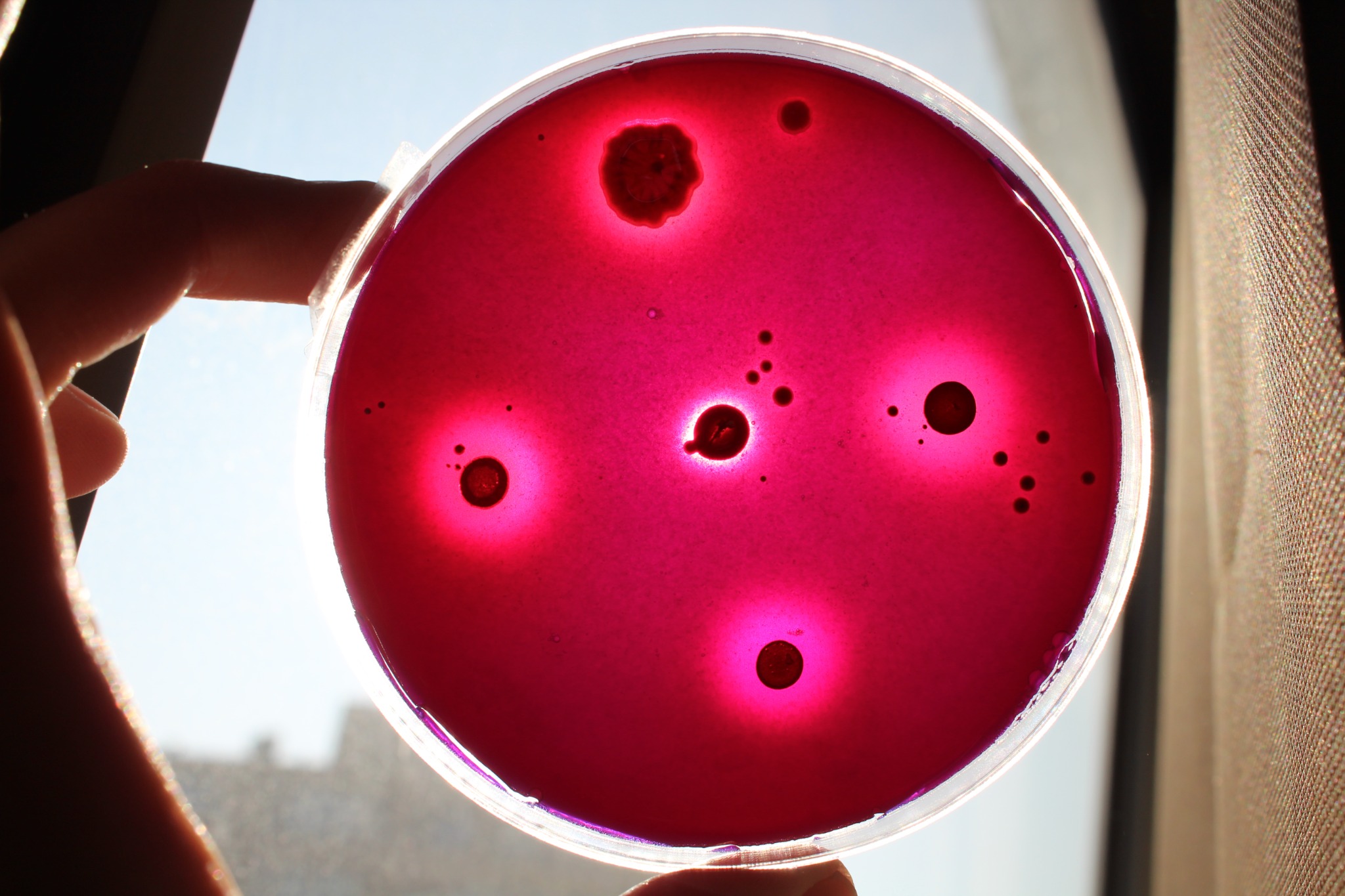 Microbial colonies growing on agar in a Petri dish